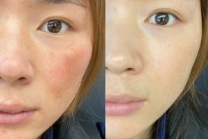 Wish I Found This Sooner - DRSEOL Transformed My Skin.