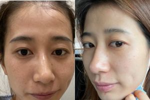 I Never Believed in Skincare - Until DRSEOL Showed Me Why I Should.