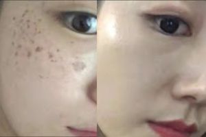 My Skin Was Fragile. DRSEOL Was the Answer.
