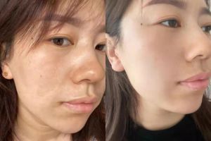 Project Leader. Mom of Two. Finally, Skincare That Works.